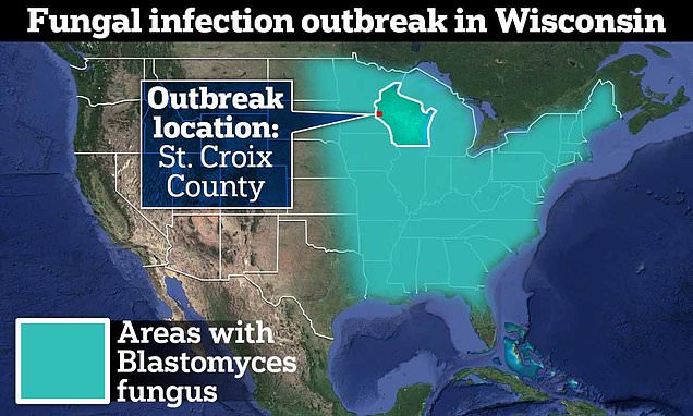 Rare Fungal Infection Strikes Wisconsin, Killing One and Hospitalizing Two.