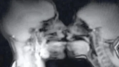 Featured image for Couple's MRI experiment offers new insights into the human body and sexuality