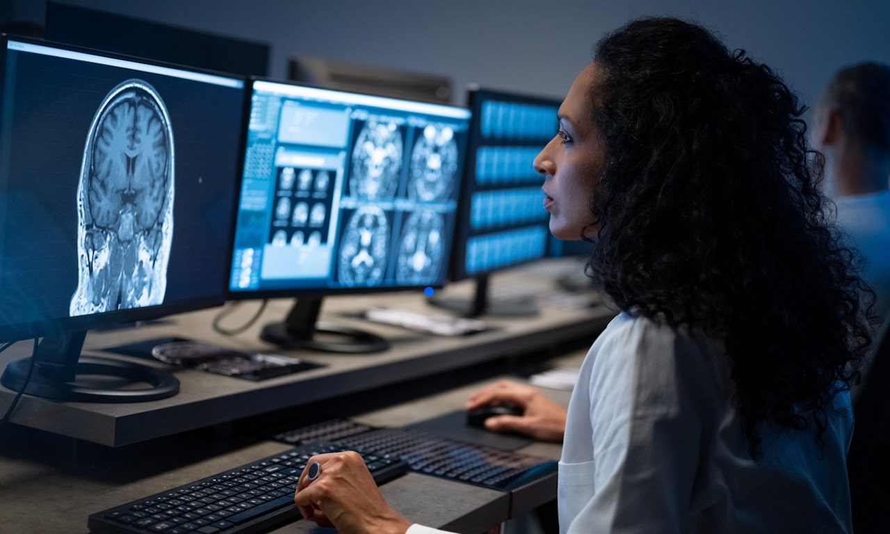 Study Identifies 5 Subgroups of Alzheimer's Patients, Paving Way for Personalized Medicine