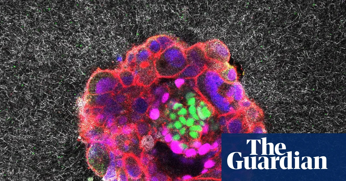 Featured image for Scientists Capture First Real-Time Footage of Human Embryo Implantation