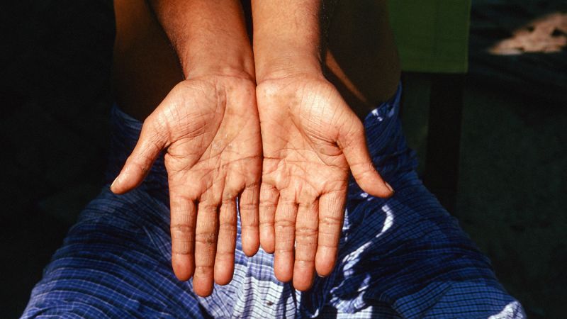 Featured image for "Global Concern: Millions Exposed to Arsenic in Drinking Water"