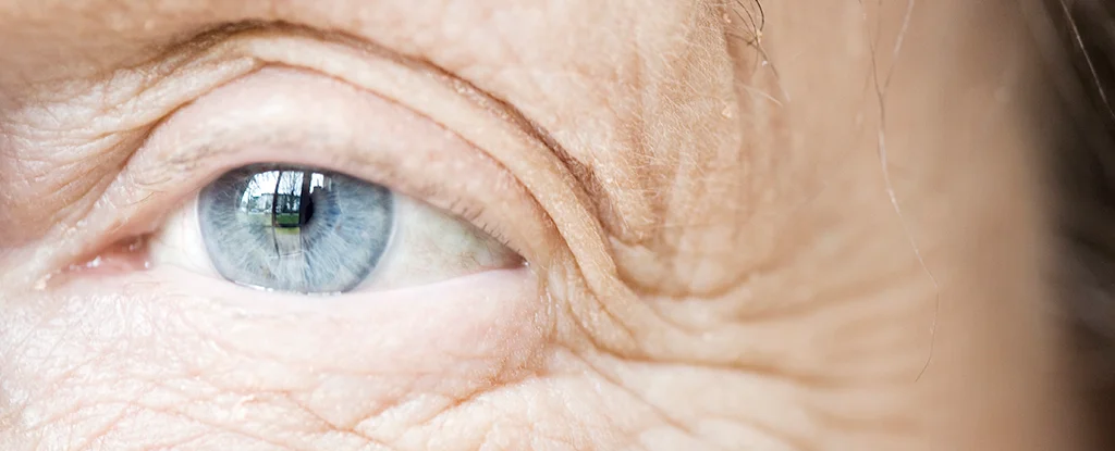 Featured image for Scientists Reveal Why Skin Wrinkles with Age