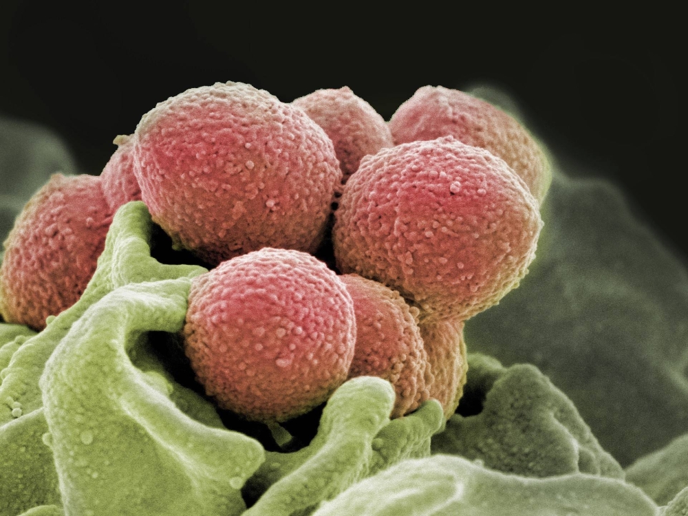Featured image for Understanding Streptococcal Infections in Japan