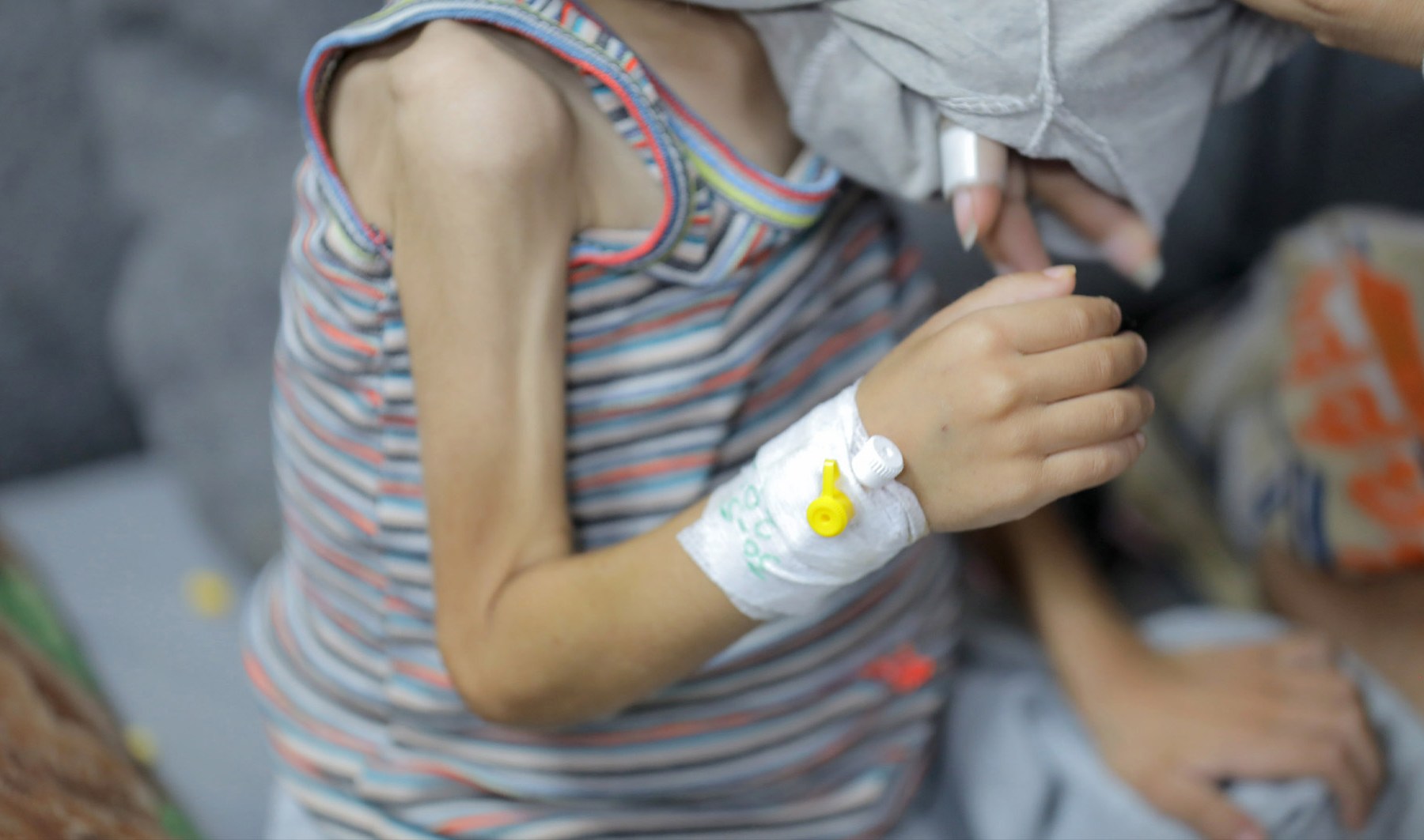 "Starvation Crisis in Gaza Claims Lives of Children"