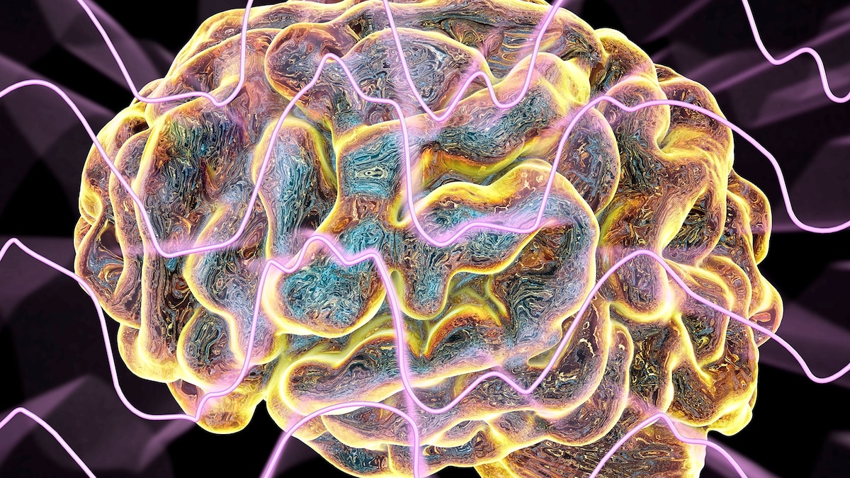 Featured image for The Mystery of Exploding Head Syndrome: A Disturbing Sleep Condition