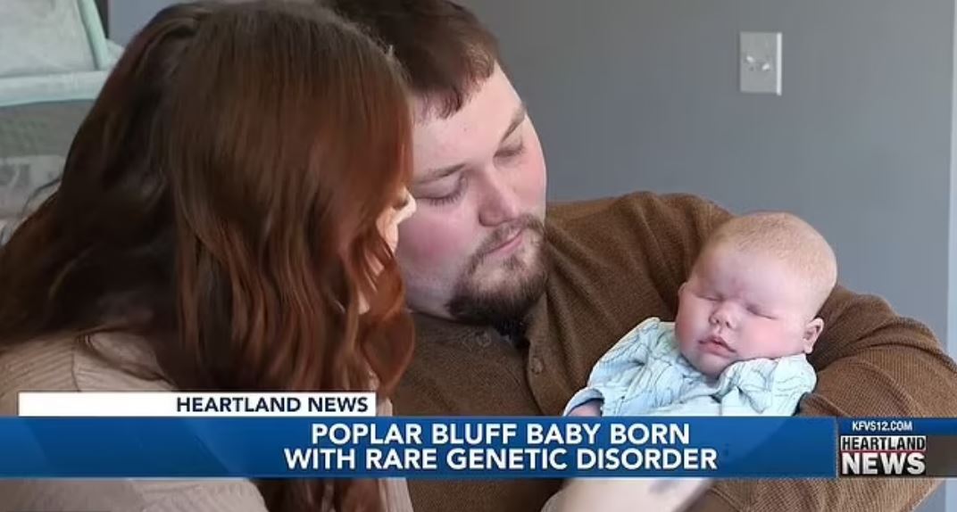 Featured image for "Rare Genetic Disorder Leaves Baby Girl Born Without Eyes, Stuns Parents"