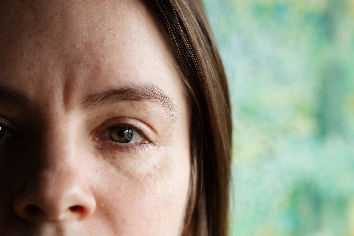 Featured image for Decoding the Visual Phenomena of Migraine Aura