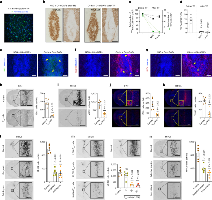 Enhancing Parkinson's stem-cell therapy with autologous Treg cells