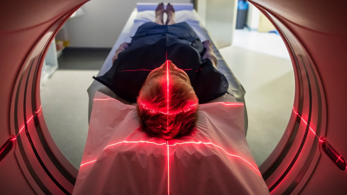 Featured image for Key Action to Prevent Alzheimer's Symptoms