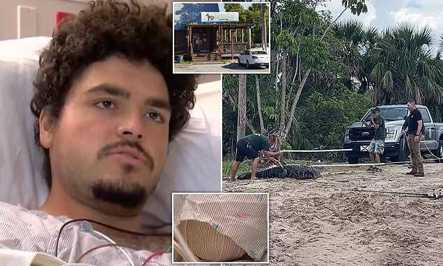 Featured image for Florida Man Loses Arm in Alligator Attack
