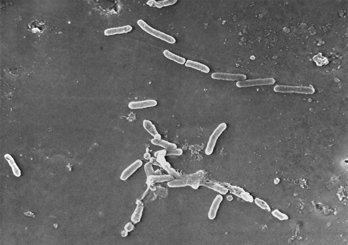 US Eye Drop Recall Linked to Fourth Death from Bacteria