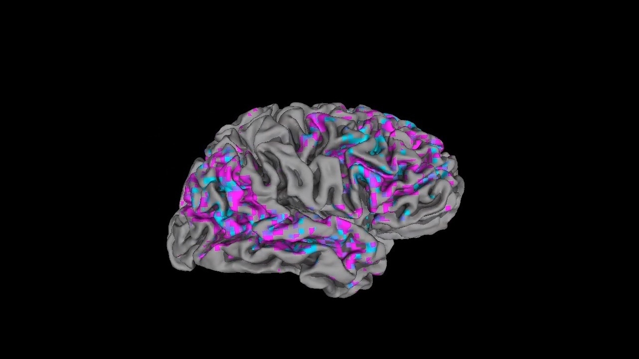 Advancements in AI and fMRI allow for passive mind-reading and decoding of language signals.