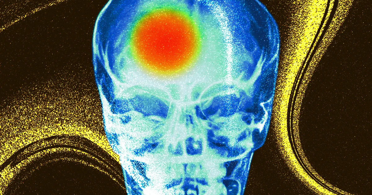 "Rising Stroke Deaths: The Link to Climate Change"