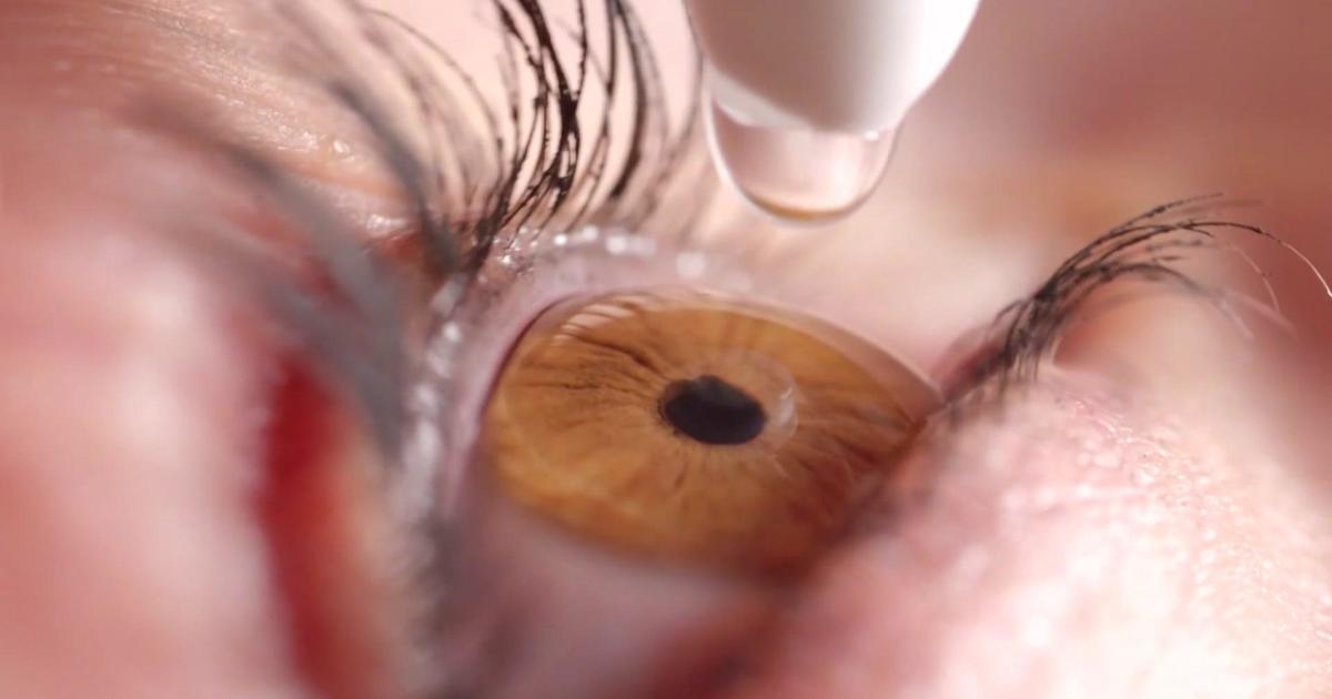 FDA Issues Warning: 26 Eye Drop Products Linked to Infection and Vision Loss