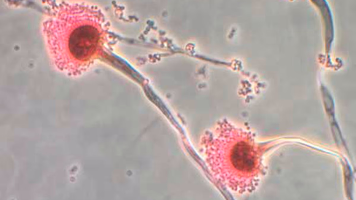 Featured image for Global Spread of Deadly Fungus Threatening Lives Amid Climate Change