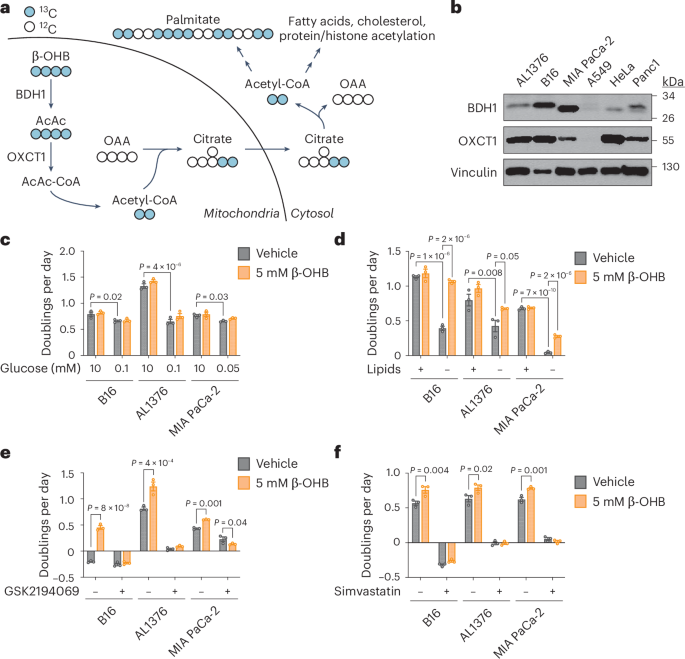 Featured image for New Pathway for β-Hydroxybutyrate in Cancer Cell Metabolism