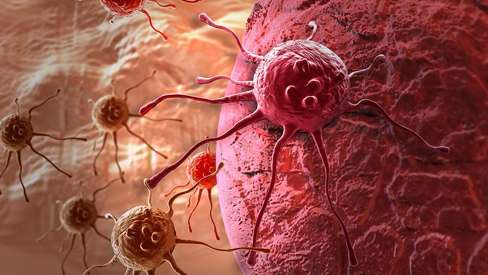 Featured image for Replimune Shares Drop 75% After FDA Skin Cancer Drug Rejection