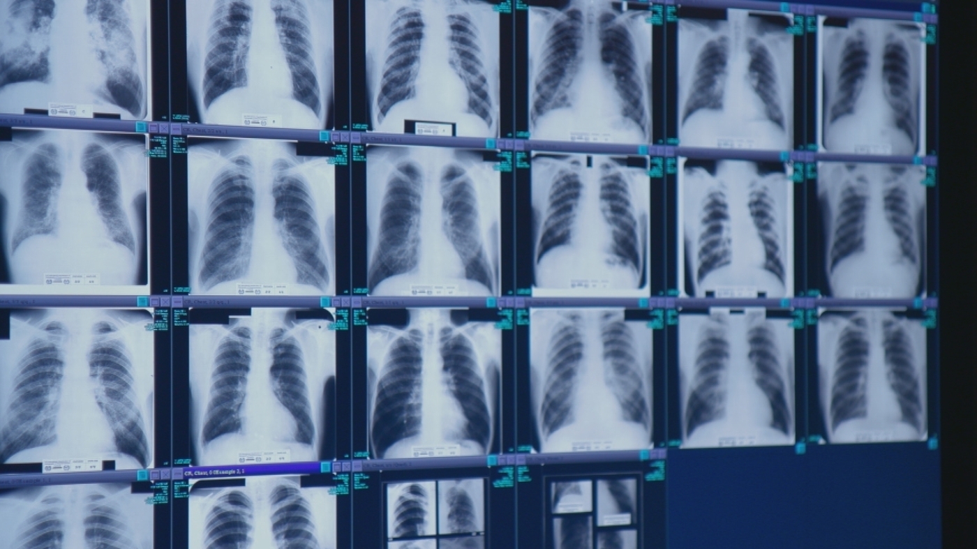 Featured image for "Federal Regulations Combat Resurgence of Deadly Black Lung Disease"