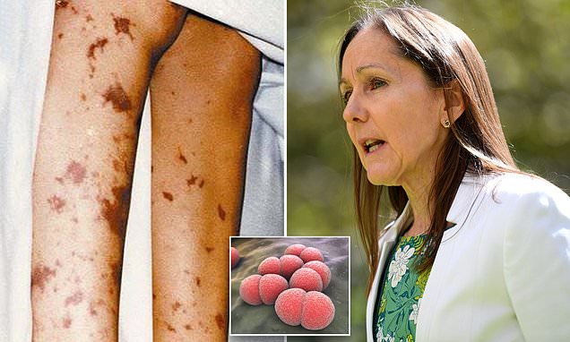 Meningococcal Outbreak Sparks Urgent Health Alert in Sydney