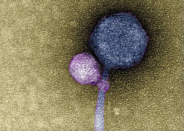"Terrifying 'Vampire Virus' Unearthed in US Soil: What You Need to Know"