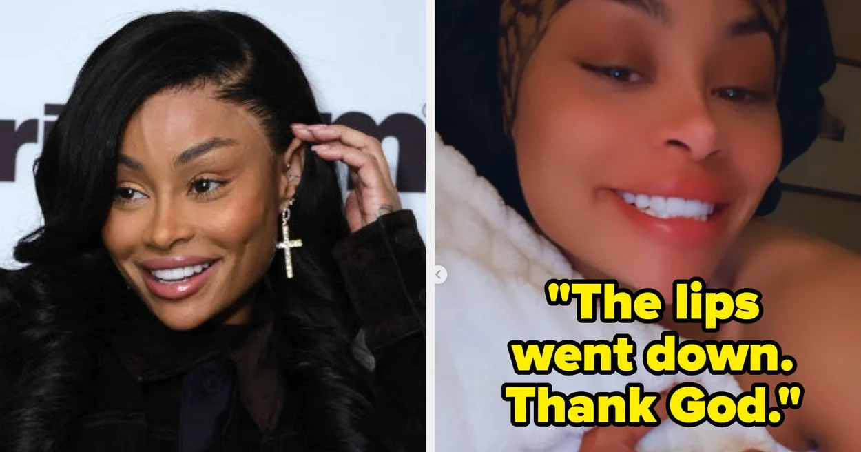 Blac Chyna's Transformation: Before and After Filler Removal.