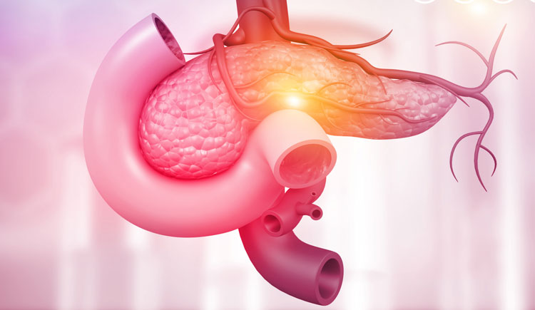 AI predicts pancreatic cancer risk years in advance