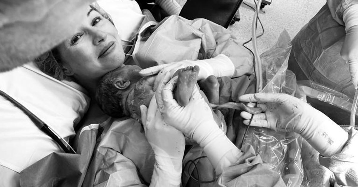 Featured image for "Empowering Self-Participation in C-Sections: A Revolutionary Approach"