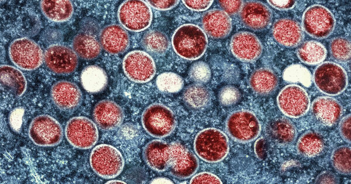 Featured image for L.A. County Reports First Local Case of More Severe, Easily Spread Mpox Strain