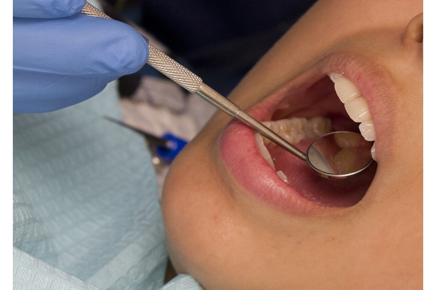 Featured image for Gum Disease and Arterial Plaque Increase Heart Disease Risk