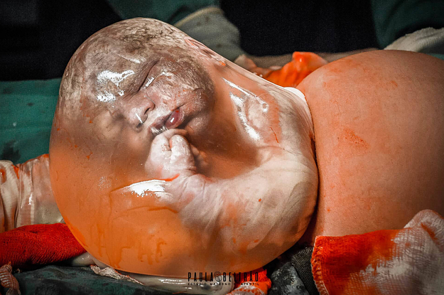 "Capturing the Beauty and Emotion of Birth: Award-Winning Photos"
