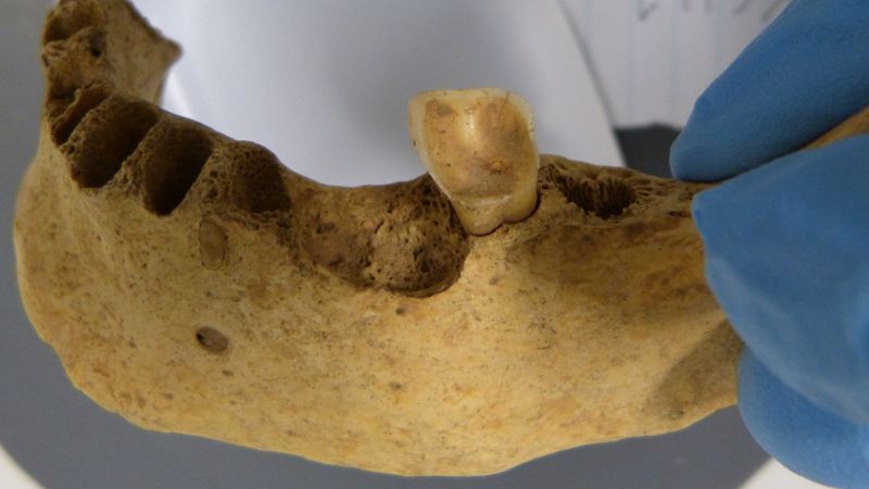 Featured image for "Uncovering Ancient Diets: Bacteria in Bronze Age Teeth Shed Light on Human Health"