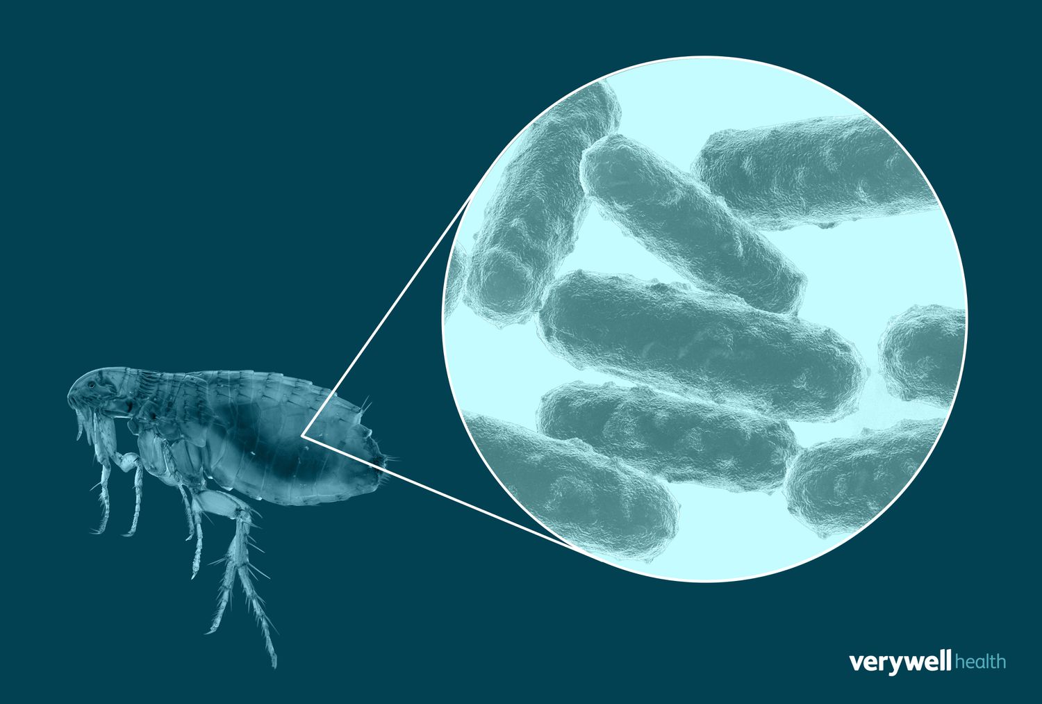 Featured image for "The Resurgence of Bubonic Plague: What You Should Know"