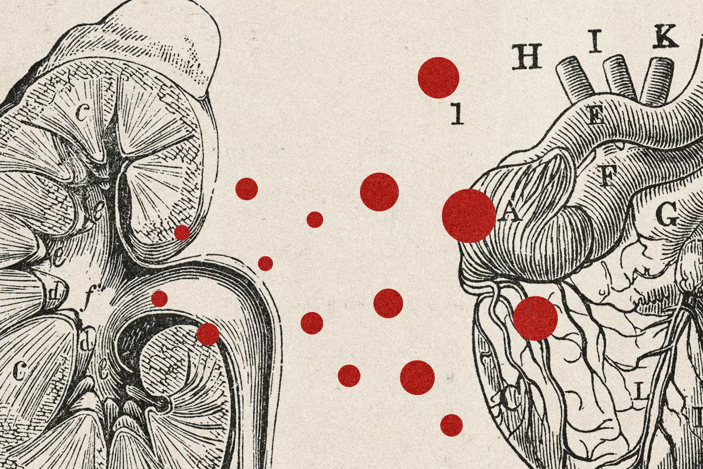Tiny kidney particles may trigger heart failure in CKD patients