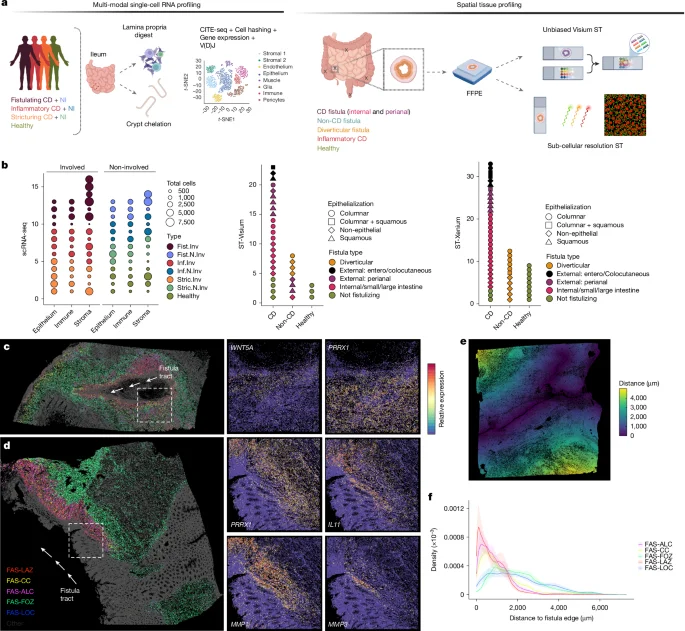 Featured image for Fibroblast Niches Drive Crohn’s Fistula Formation