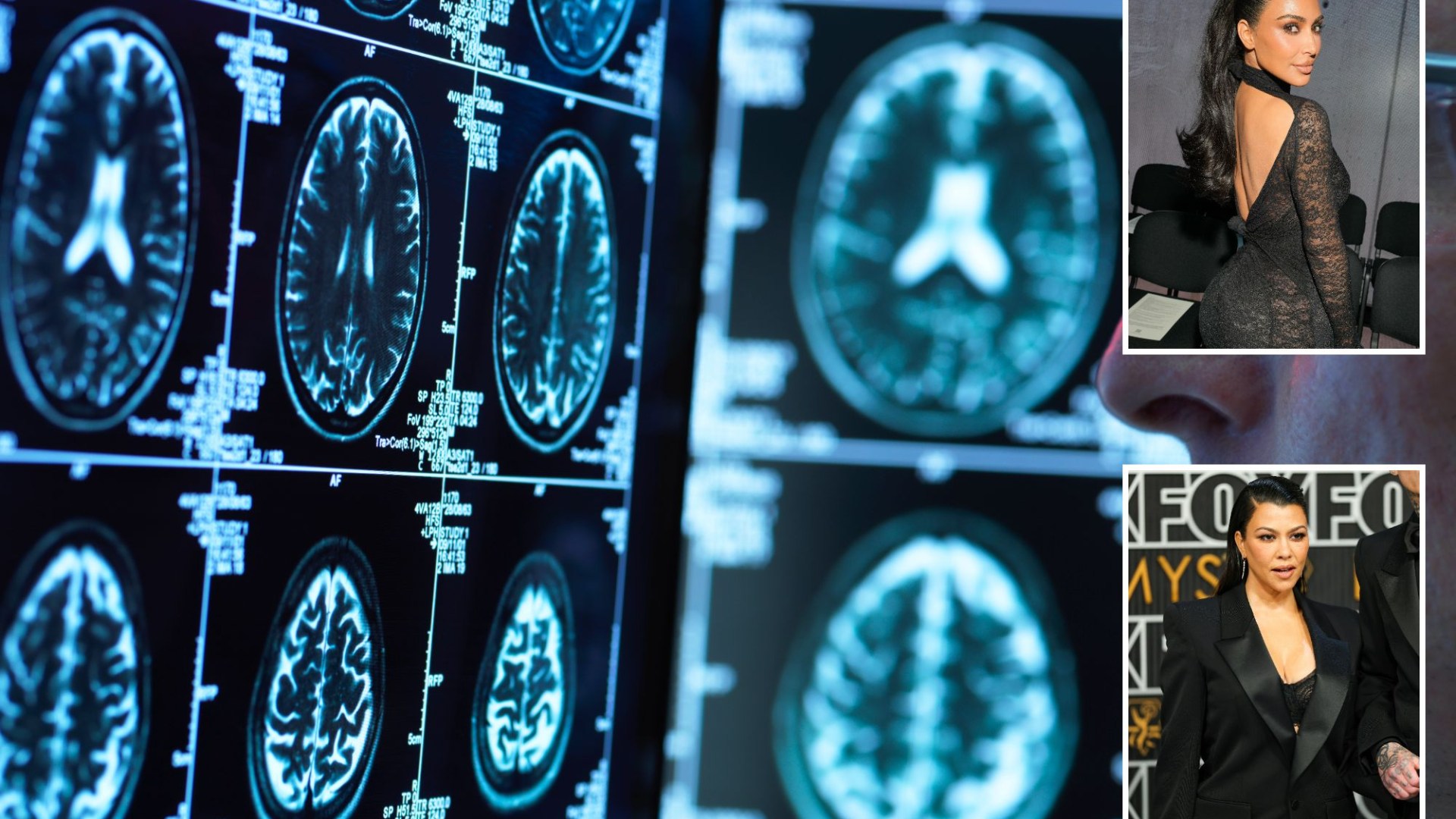 Featured image for "Kardashian-Approved Diet Linked to Delaying Alzheimer's Symptoms, Study Shows"