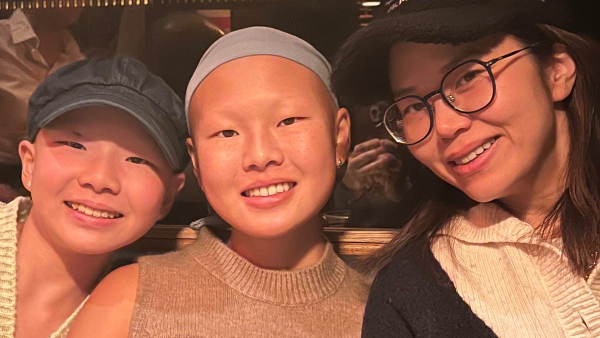 FDA approves Pfizer's Litfulo for severe alopecia areata in teens and adults.