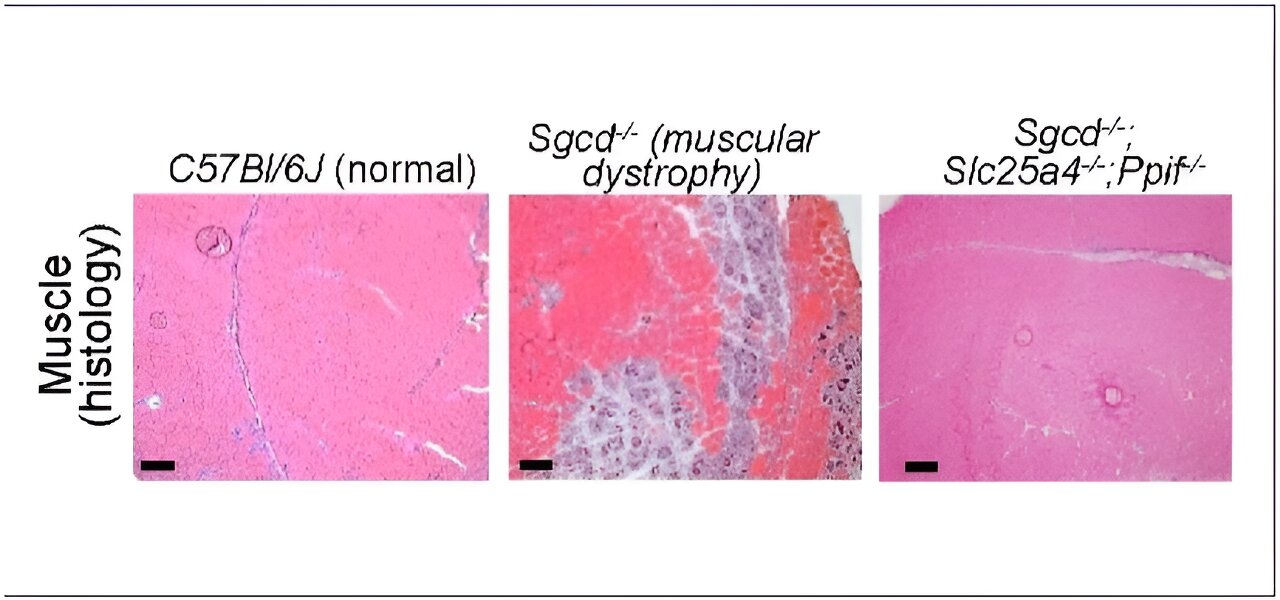 Featured image for Unveiling the Mitochondria Pore: A Breakthrough in Muscular Dystrophy Management