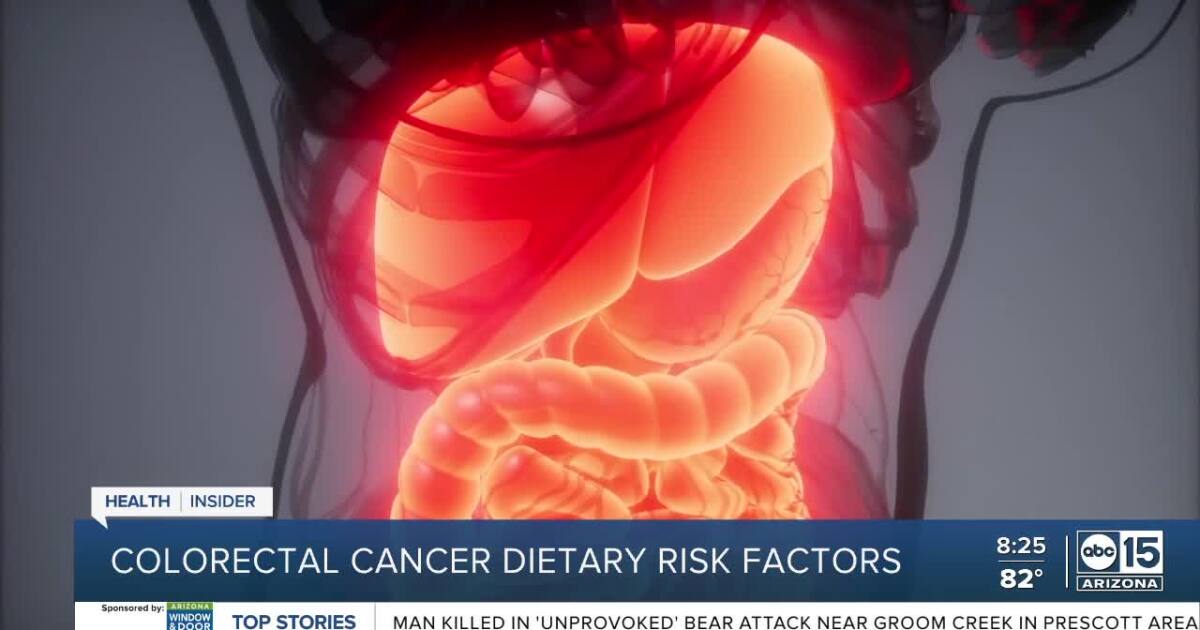 Featured image for Reducing the Risk of Colorectal Cancer: Insights and Warnings.