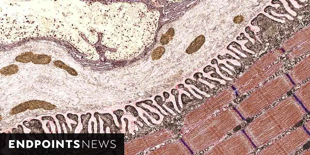 Featured image for CAR-T cell therapy shows promise for rare autoimmune disorder in clinical trial.