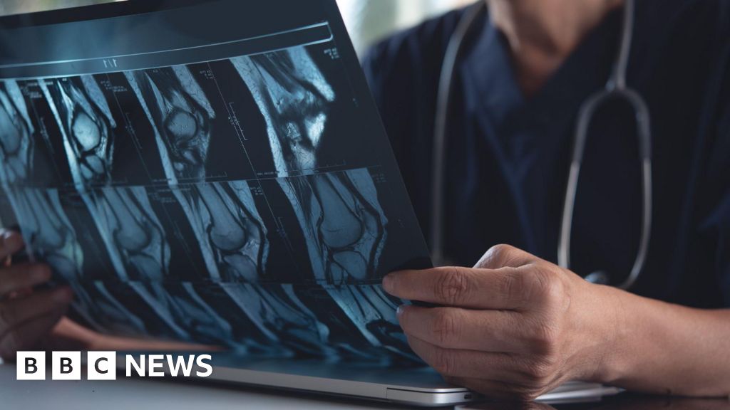 Featured image for AI predicts future X-rays, revolutionizing osteoarthritis care