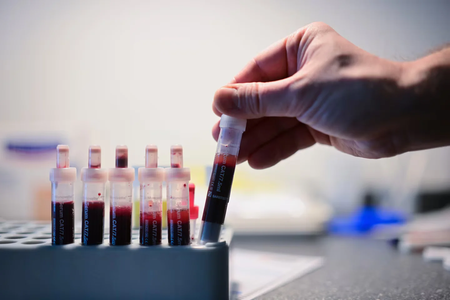 Featured image for Advances in HIV Research Point Toward Potential Cure and Long-Term Control