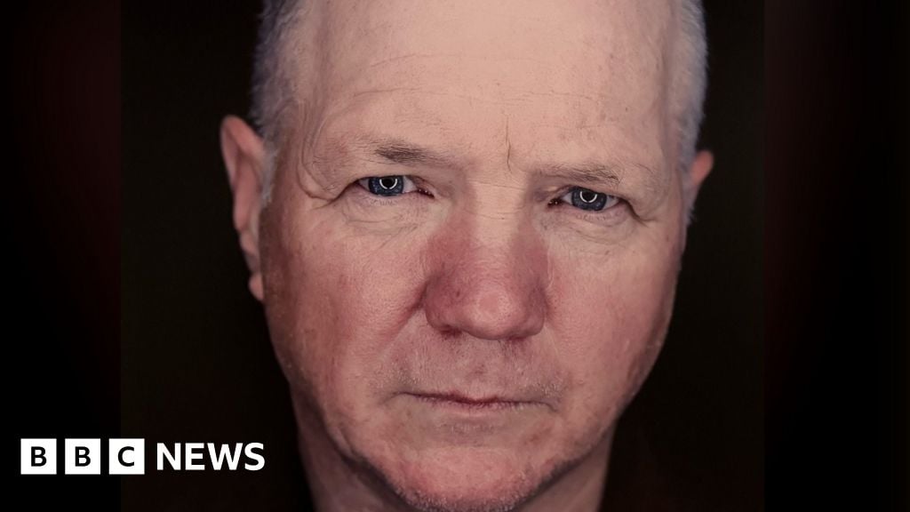 Featured image for NI Offers Celtic Curse Testing for Haemochromatosis