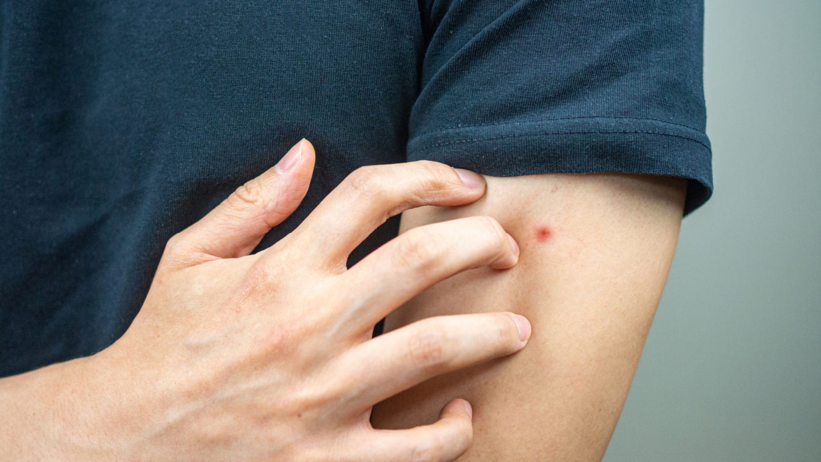 Featured image for Bug Bite Relief: Device 'Burns' Away Nightmare Itch