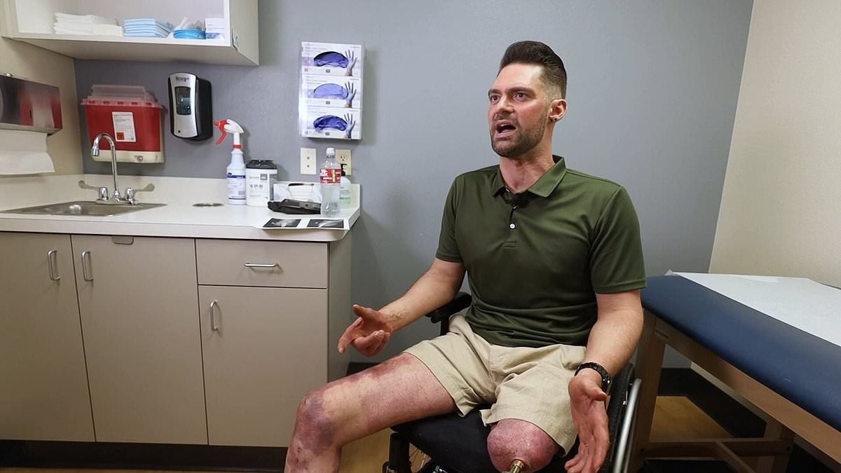 "Double Amputee Walks Normally Again After Revolutionary Surgery"