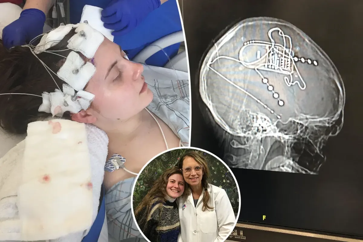 Panic attacks revealed epilepsy — a brain implant stopped the seizures