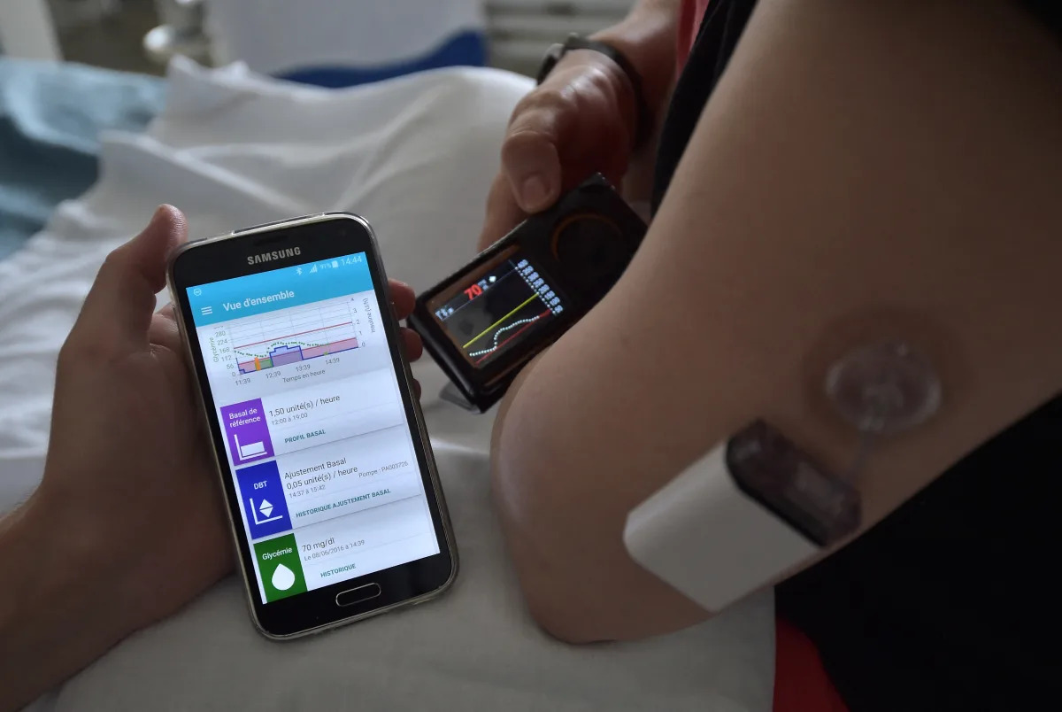 Featured image for "England's NHS to Roll Out Artificial Pancreas for Thousands of Diabetes Patients"