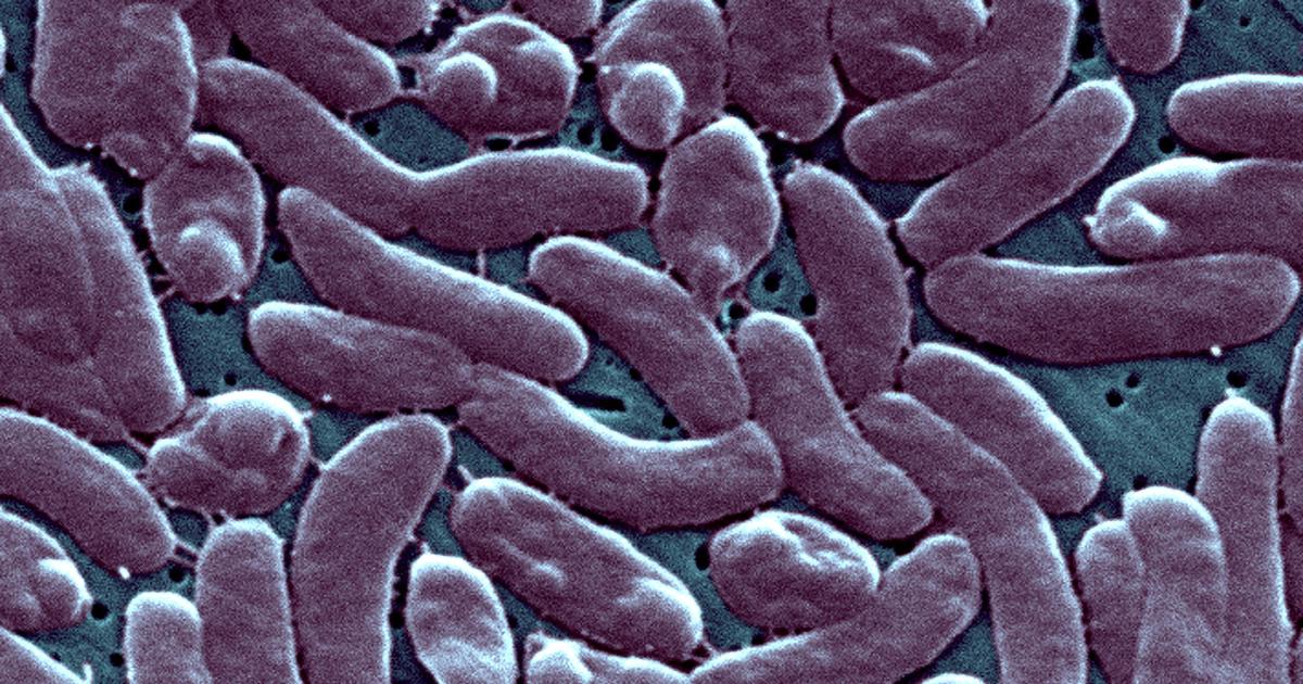 Featured image for "Deadly Outbreak: Rare Flesh-Eating Bacteria Claims Lives in Northeastern US"