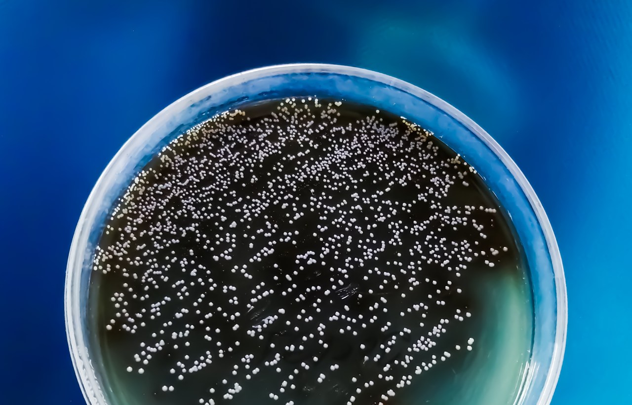 The Spread of Deadly Drug-Resistant Fungus in the US and Canada.
