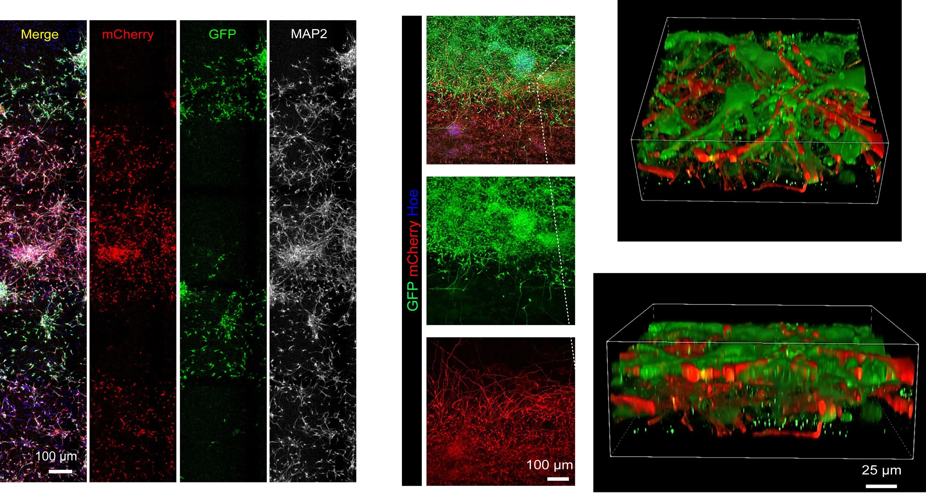 Featured image for "Advancements in 3D Printing Human Brain Tissue for Research"
