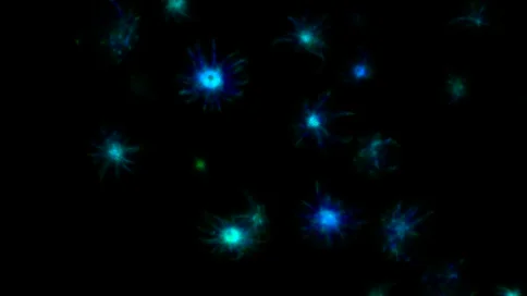 The Spark of Neurodegenerative Diseases: Huntington's and Alzheimer's.